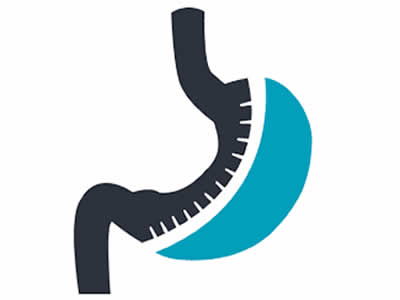 manga gastrica RIOBAMBA 