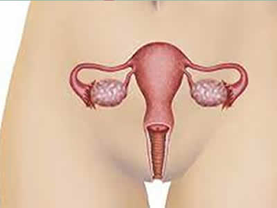 Cirugía de Ùtero Riobamba