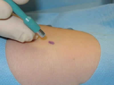 Cirugía de Piel Riobamba