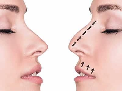 OTORRINOLARINGOLOGOS RIOBAMBA.